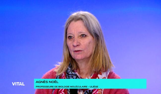 Lymphœdème : Un défi médical méconnu