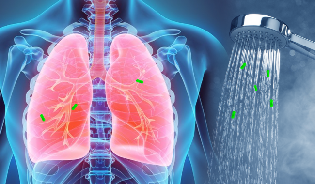 Légionellose : la province de Liège largement la plus touchée !