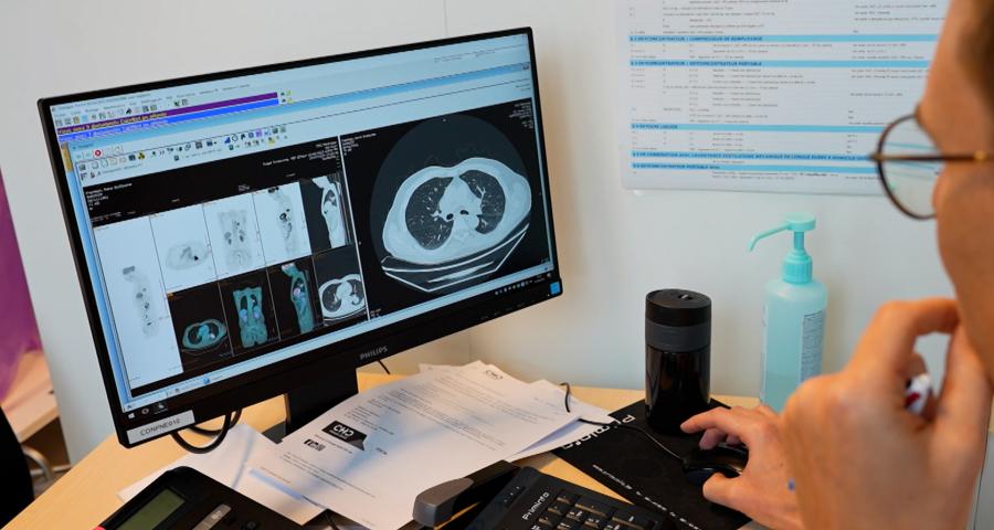 Cancer du poumon : + de femmes et + de non-fumeurs